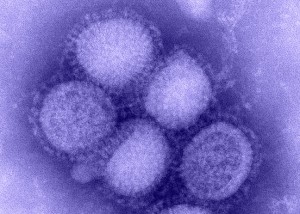 The A/H1N1 virus is taking lives in all three Baltic states, with Lithuania declared a national pandemic and Latvia with several epidemic zones.